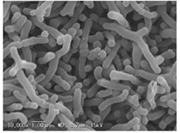 「ビフィズス菌OLB6378」の顕微鏡写真